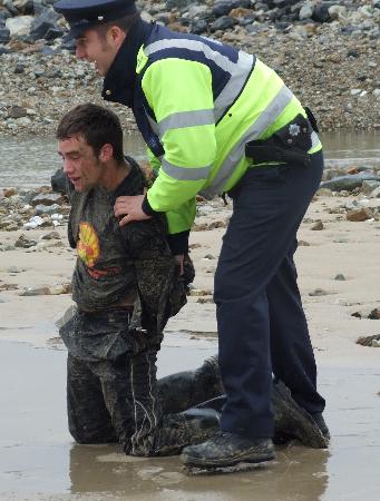 Another Shell protester after assault by Gardai